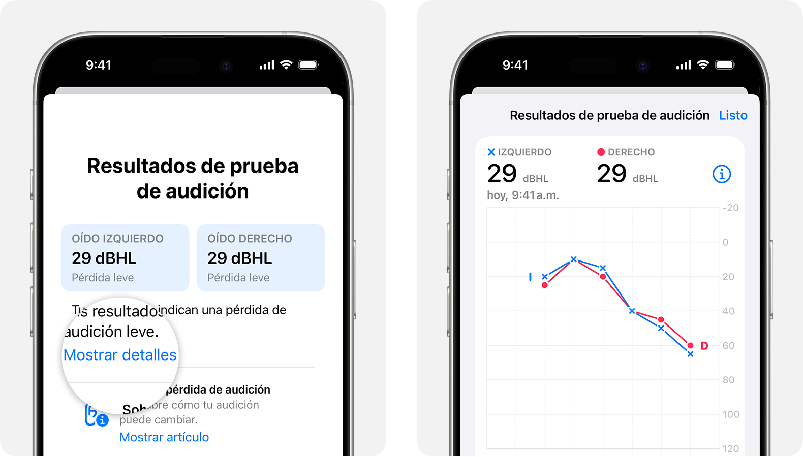 Resultados detallados de una prueba de audición realizada en los AirPods Pro 2 en un iPhone.