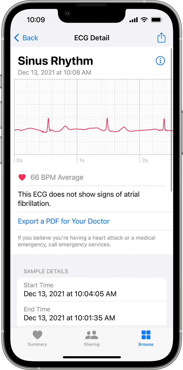 ios15-iphone13-pro-tim-xem-tóm-tắt-kết-quả-ecg