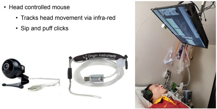 The assistive technology Chiou uses to access the computer from bed includes a head controlled mouse using an infra-red camera to track head movements and a tube that senses sips and puffs for mouse clicks. A monitor is mounted from the ceiling above him.