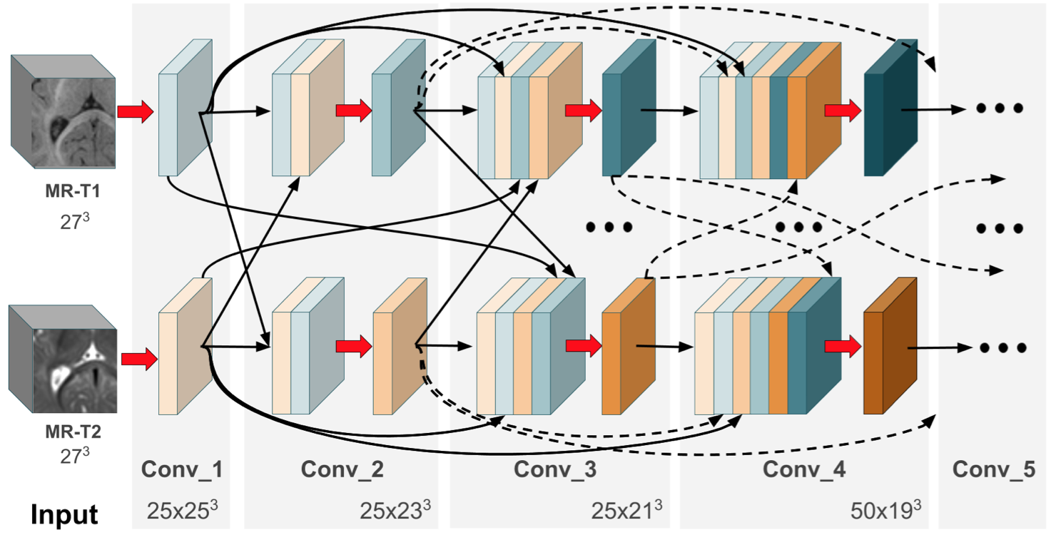 HyperDenseNet_pytorch