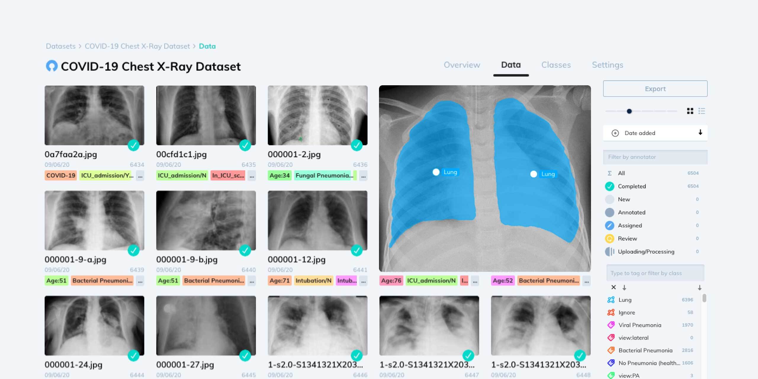 covid-19-xray-dataset