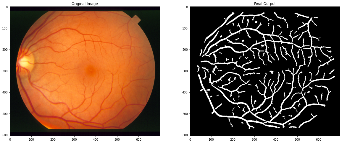 Retinal-Blood-Vessels-Segmentation-and-Denoising